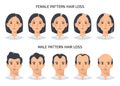 Hair loss stages, androgenetic alopecia male and female pattern Royalty Free Stock Photo