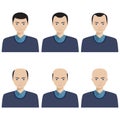 Hair loss stages and types of baldness.