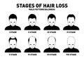 Hair loss. Stages and types of male hair loss. Male pattern baldness. Head of hairy and bald man in top view Royalty Free Stock Photo