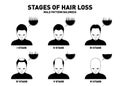 Hair loss. Stages and types of male hair loss. Male pattern baldness. Head of hairy and bald man in top view Royalty Free Stock Photo