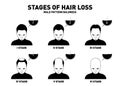 Hair loss. Stages and types of male hair loss. Male pattern baldness. Head of hairy and bald man in top view