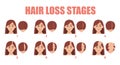 Hair loss stages vector isolated. Female alopecia