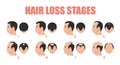 Hair loss stages vector isolated. Male alopecia