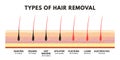 Hair removal concept. Shaving, depilation cream, waxing, epilator, plucking, laser hair removal and electrolysis