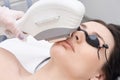 Hair removal on the face. Bright skin. Medical procedure. Laser