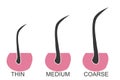 Hair thickness types classification
