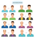 Hair transplant vector hairy transplantation after hairloss and baldness for bald man illustration set of hairless male Royalty Free Stock Photo