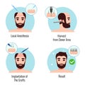 Hair Transplantation Design Concept