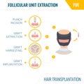 Hair transplantation by FUE method in men