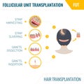 Hair transplantation by FUT method in women