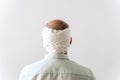 After hair transplantation surgical technique that moves hair follicles. Young bald man in bandage with hair loss Royalty Free Stock Photo