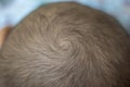 A hair whorl is a patch of hair growing in a circular direction around a visible center point