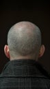 Hairstyle journey Adult male embraces baldness, prioritizing scalp health