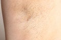 hairy armpit female closeup dark hair growing under arm before hair removal Royalty Free Stock Photo