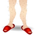 Hairy Legs and Red Slippers Royalty Free Stock Photo