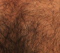 Hairy Skin