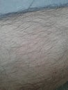 Hairy skin