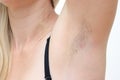 Hairy unshaved anderarms, armpit of a caucasian woman close up Royalty Free Stock Photo