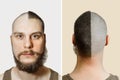 Half trimmed bald guy on isolated background. man hold comb and clipper. Concept of hair loss, alopecia, transplantation Royalty Free Stock Photo