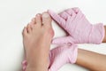 Hallux valgus, bunion in woman foot on white background