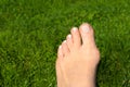 Hallux valgus, bunion in woman foot on grass background Royalty Free Stock Photo