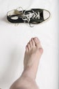 Hallux valgus and a ruined shoe. Royalty Free Stock Photo