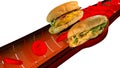 Hamburger artery cholesterol blood