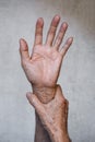 Hand of Asian elder man. Concept of joint pain, rheumatoid arthritis or hand problems Royalty Free Stock Photo