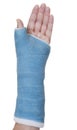 Hand in blue cast on white background