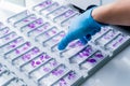 Hand in blue glove holding glass histology slides