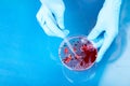 Hand in blue glove holding petri dish with bacterium . Microbiology sience