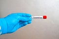 Hand in blue medical disposable rubber gloves holding a blank test tube to collect analyzes on a gray background with the Royalty Free Stock Photo