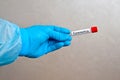 Hand in blue medical disposable rubber gloves holding a blank test tube to collect analyzes on a gray background with the Royalty Free Stock Photo
