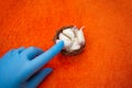 Hand in blue medical glove with Cloves of raw Garlic in wooden small bowl