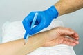 Hand with blue medical glove holding a surgical scalpel to make an incision on an arm.