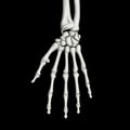 Hand Bones