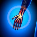 Hand / Carpals / Metacarpals / Phalanges - Anatomy Bones Royalty Free Stock Photo