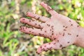 Hand is covered with ants Royalty Free Stock Photo