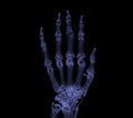 Hand 3D rendering for rheumatoid arthritis Concept