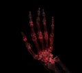 Hand 3D rendering for rheumatoid arthritis Concept