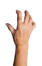 Hand Deformed From Rheumatoid Arthritis Royalty Free Stock Photo