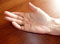 Hand disease(Dupuytren)