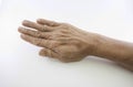 Hand and finger man rough skin wrinkles. Royalty Free Stock Photo