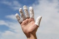 Hand in front of blue sky, injured finger Royalty Free Stock Photo