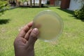 agar medium in petri dish for microbial plate count