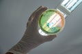 Hand holding an agar plate cultured with Pseudomonas aeruginosa