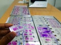 Hand holding histopathology slides stained with leishman stain, displayed and ready for microscopy