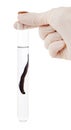 Hand holding a leech in a flask Royalty Free Stock Photo