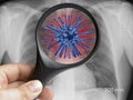 Hand holding magnifying glass focusing on virus cell on lung chest xray