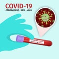 Hand holding test tube with positive Coronavirus result. Virus cell with scary and evil face. Laboratory analysis of Coronavirus Royalty Free Stock Photo